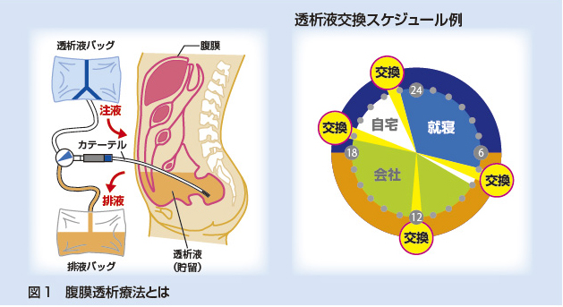 血腹症はどのように診断されますか?