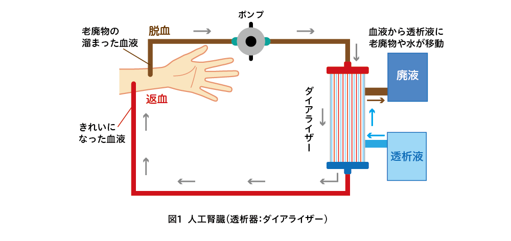 脱血から返血までの簡単な図です。