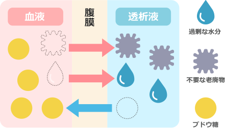 腹膜透析のしくみ