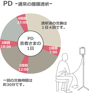 PD -通常の腹膜透析-